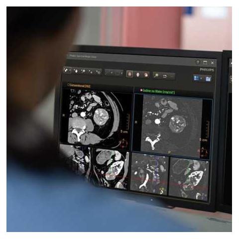 Verida CT设备特写