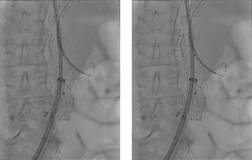 ARTIS pheno.vision设备操作界面