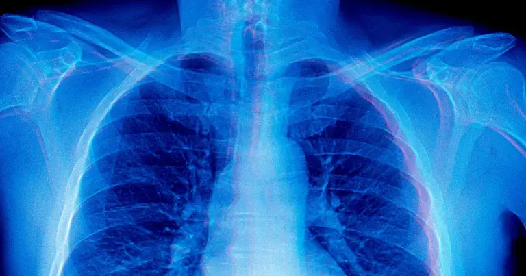 前沿AI模型在诊断医学X光片时表现出极其奇怪的行为